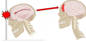 cranio